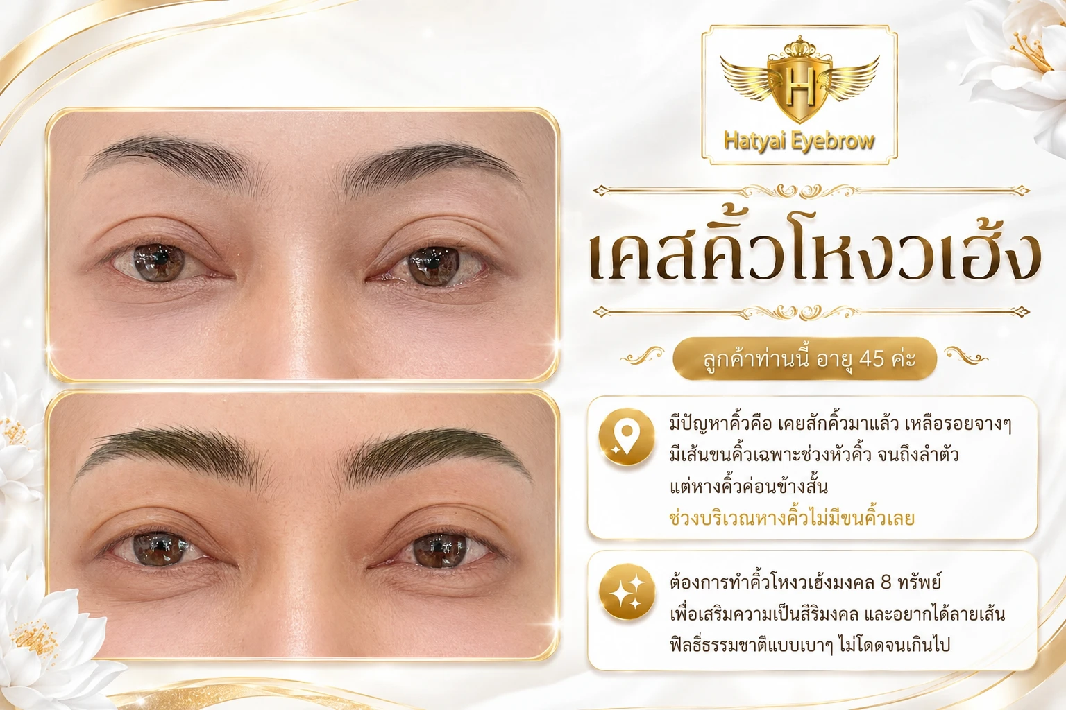 ลูกค้าท่านนี้ อายุ 45 ตั้งแต่เปิดร้านมาจะ 10 ปีแล้วก็เพิ่งเจอคนนี้คนแรก เคยสักคิ้วมาแล้ว เหลือรอยจางๆ มีเส้นขนคิ้วเฉพาะช่วงหัวคิ้ว
