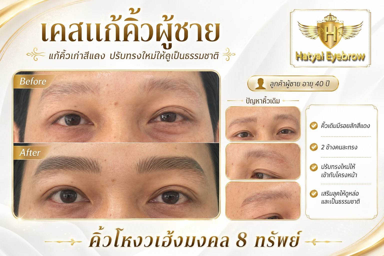 ลูกค้าผู้ชาย อายุ40 ลูกค้าท่านนี้เคยสักคิ้วมาแล้วค่ะ มีรอยสักสีแดง เส้นใหญ่ เส้น2 ข้าง คนละทรง คนละเส้น